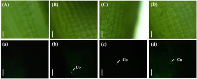 Visualization of the entire process of rice spikelet infection by Ustilaginoidea virens through nondestructive inoculation